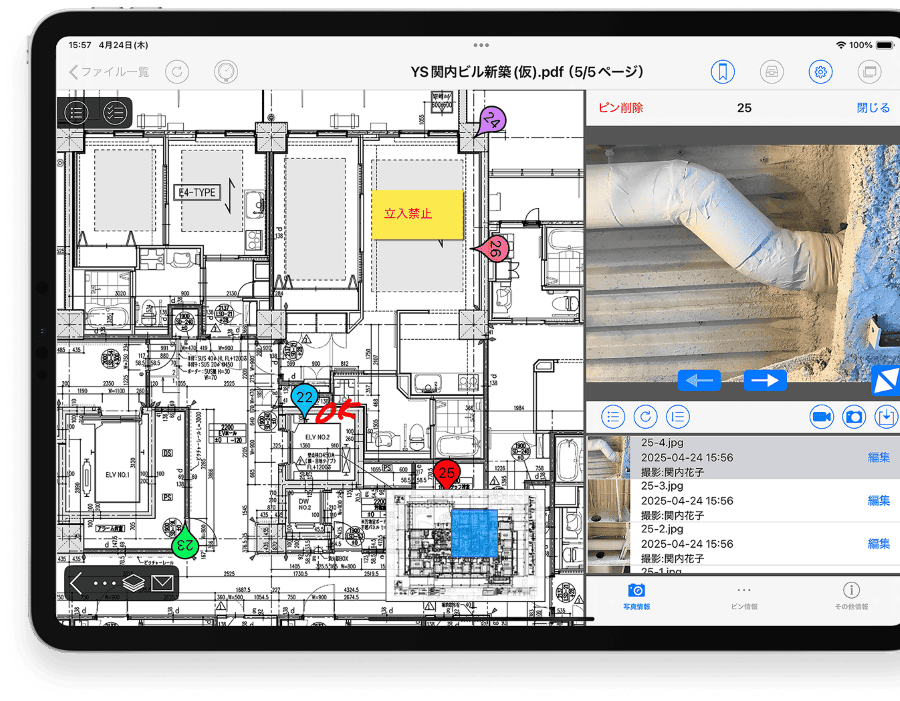 CheXのイメージ画像